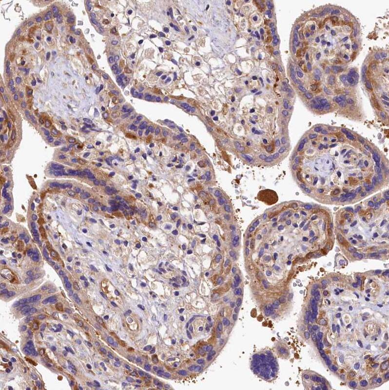 QARS Antibody - BSA Free Immunohistochemistry-Paraffin: QARS Antibody - BSA Free [NBP1-89487]