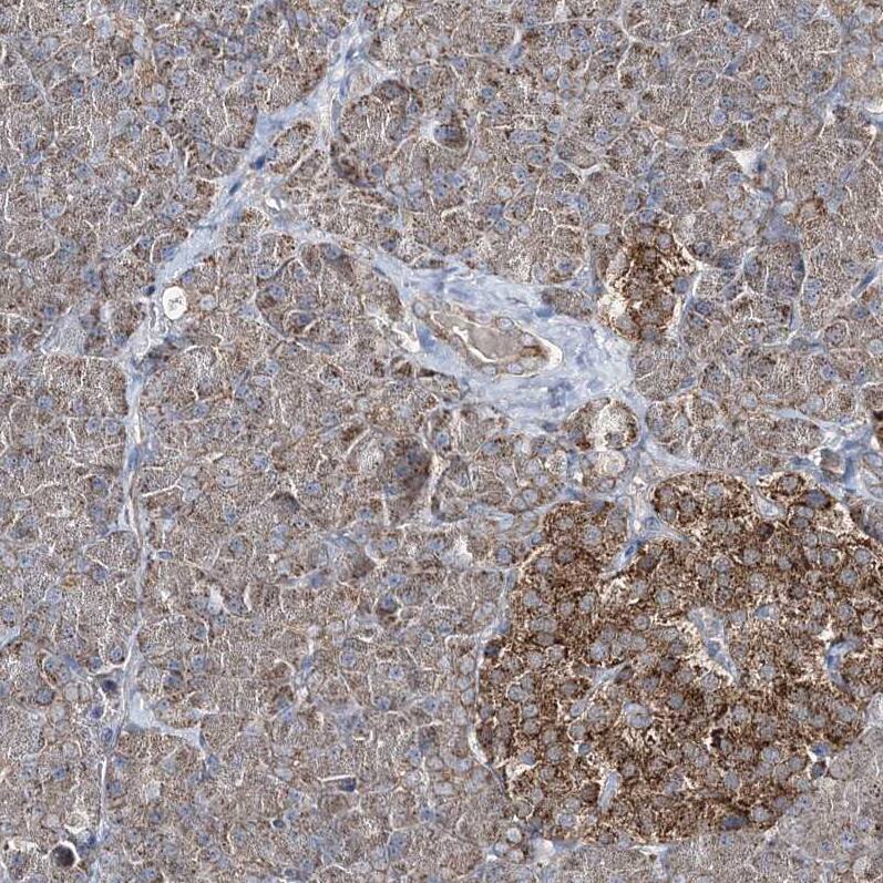 GRSF1 Antibody - BSA Free Immunohistochemistry-Paraffin: GRSF1 Antibody - BSA Free [NBP1-89488]