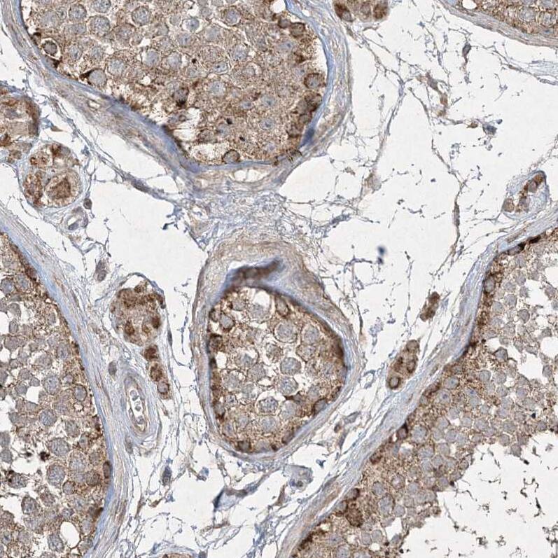 GRSF1 Antibody - BSA Free Immunohistochemistry-Paraffin: GRSF1 Antibody - BSA Free [NBP1-89488]