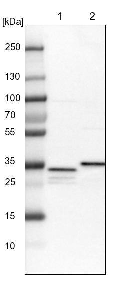 SUCLG1 Antibody - BSA Free Western Blot: SUCLG1 Antibody - BSA Free [NBP1-89489]