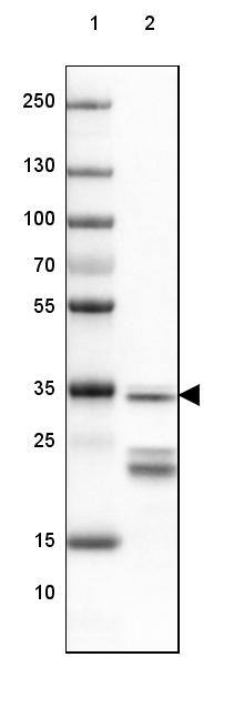 SUCLG1 Antibody - BSA Free Western Blot: SUCLG1 Antibody - BSA Free [NBP1-89489]