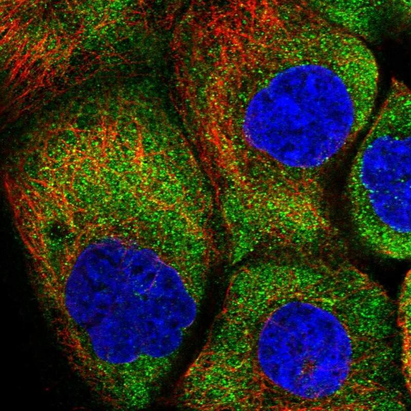 HARS Antibody - BSA Free Immunocytochemistry/ Immunofluorescence: HARS Antibody - BSA Free [NBP1-89490]