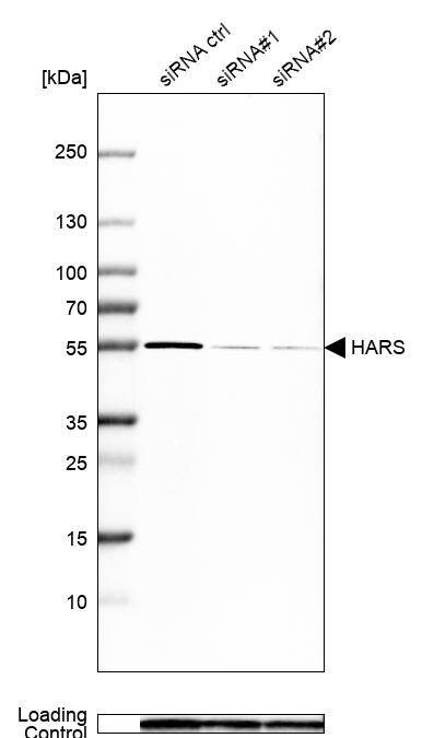 HARS Antibody - BSA Free Western Blot: HARS Antibody - BSA Free [NBP1-89490]