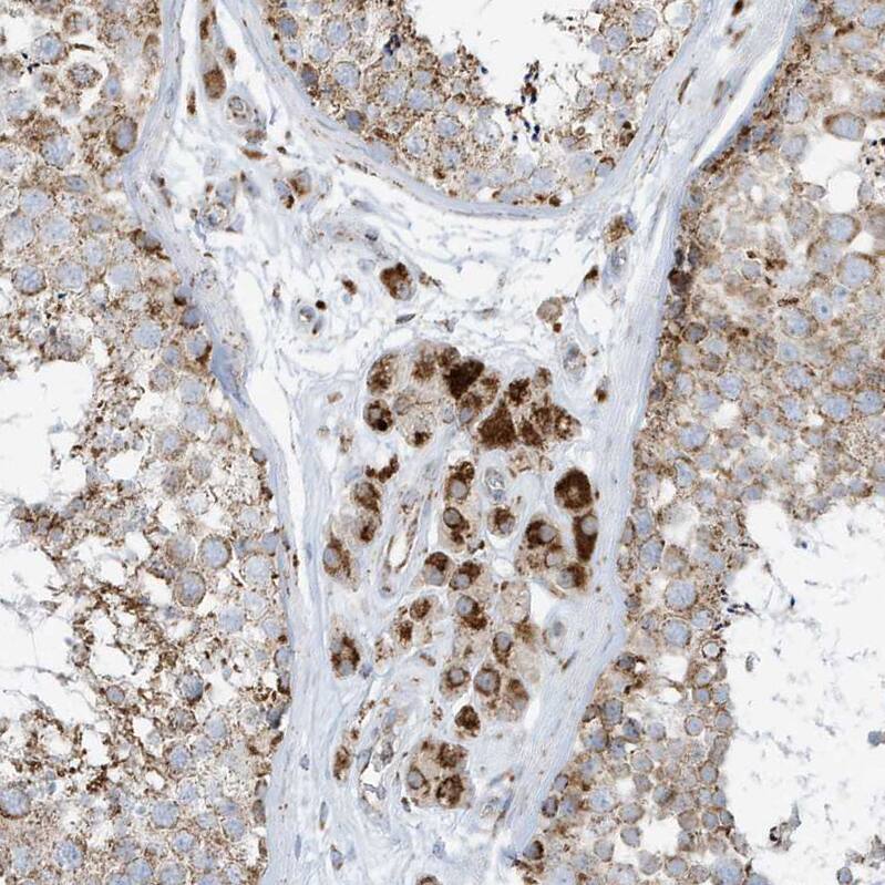 ATP5I Antibody - BSA Free Immunohistochemistry-Paraffin: ATP5I Antibody - BSA Free [NBP1-89496]