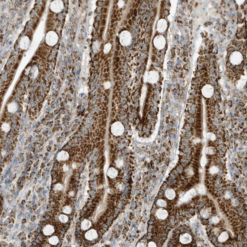 ATP5I Antibody - BSA Free Immunohistochemistry-Paraffin: ATP5I Antibody - BSA Free [NBP1-89496]