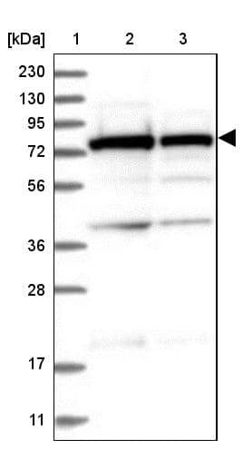 SRP72 Antibody - BSA Free Western Blot: SRP72 Antibody - BSA Free [NBP1-89498]