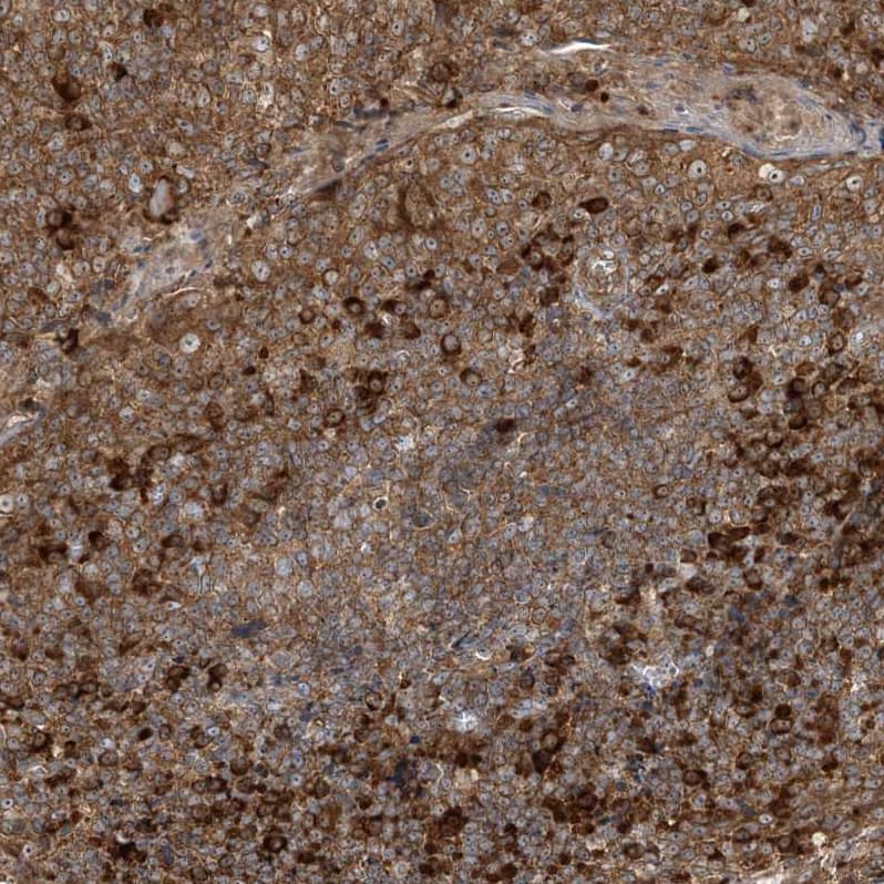SRP72 Antibody - BSA Free Immunohistochemistry-Paraffin: SRP72 Antibody - BSA Free [NBP1-89498]
