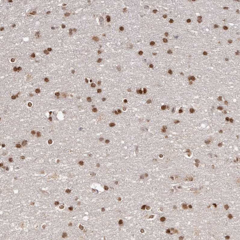 SOX4 Antibody - BSA Free Immunohistochemistry-Paraffin: SOX4 Antibody - BSA Free [NBP1-89506]