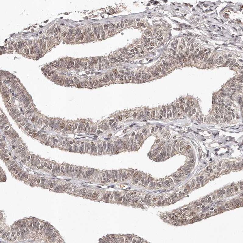 SOX4 Antibody - BSA Free Immunohistochemistry-Paraffin: SOX4 Antibody - BSA Free [NBP1-89506]