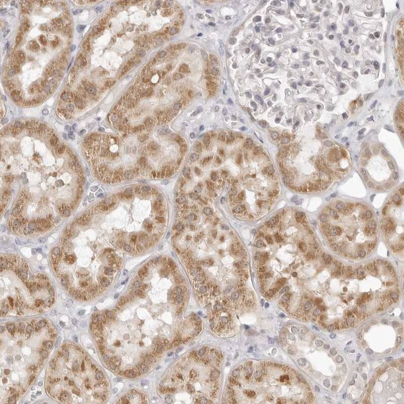FDPS Antibody - BSA Free Immunohistochemistry-Paraffin: FDPS Antibody - BSA Free [NBP1-89509]