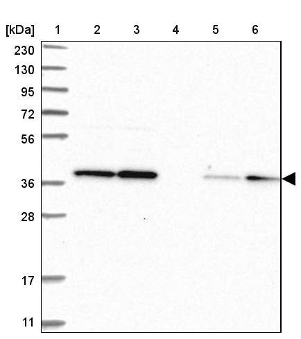 FDPS Antibody - BSA Free Western Blot: FDPS Antibody - BSA Free [NBP1-89509]