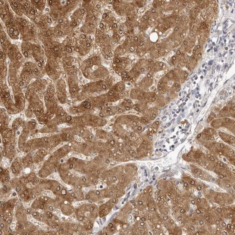 FDPS Antibody - BSA Free Immunohistochemistry-Paraffin: FDPS Antibody - BSA Free [NBP1-89509]