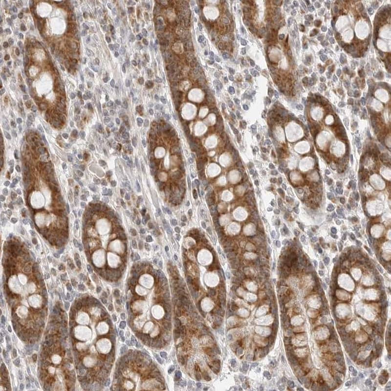 DYRK4 Antibody - BSA Free Immunohistochemistry-Paraffin: DYRK4 Antibody - BSA Free [NBP1-89511]