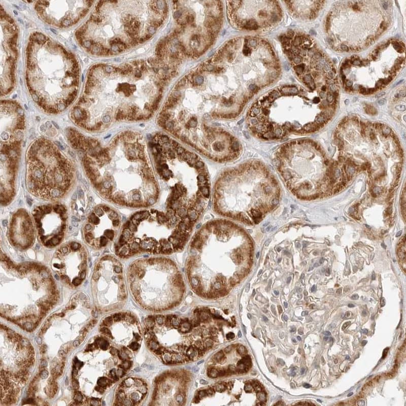 DYRK4 Antibody - BSA Free Immunohistochemistry-Paraffin: DYRK4 Antibody - BSA Free [NBP1-89511]