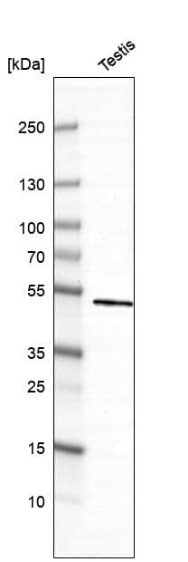 DYRK4 Antibody - BSA Free Western Blot: DYRK4 Antibody - BSA Free [NBP1-89511]