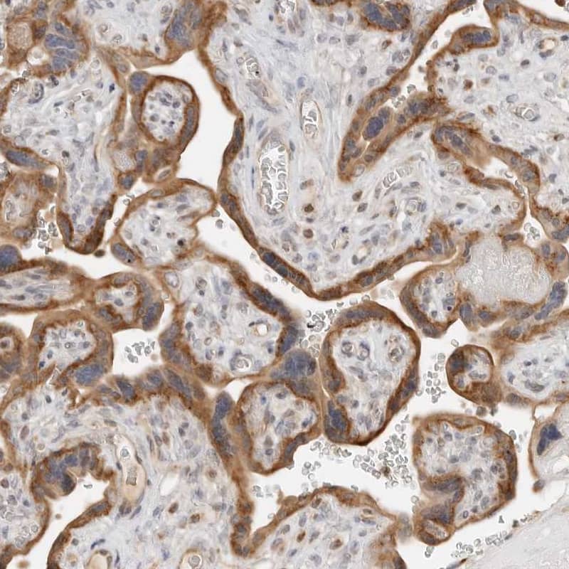 DYRK4 Antibody - BSA Free Immunohistochemistry-Paraffin: DYRK4 Antibody - BSA Free [NBP1-89511]