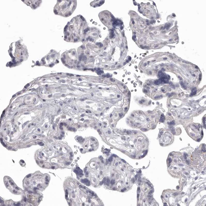 MDH1 Antibody - BSA Free Immunohistochemistry-Paraffin: MDH1 Antibody - BSA Free [NBP1-89515]