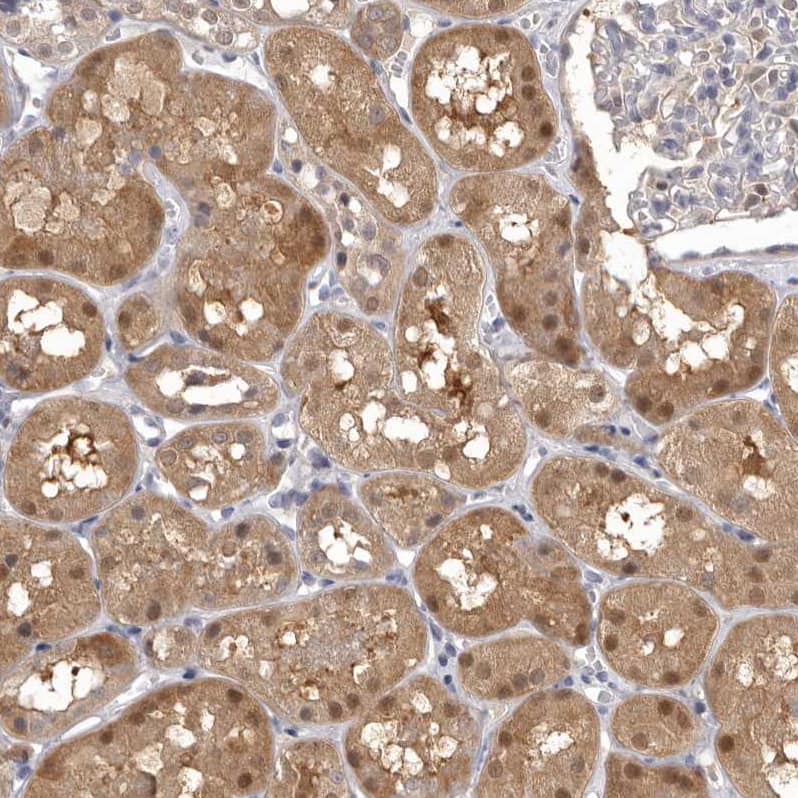 MDH1 Antibody - BSA Free Immunohistochemistry-Paraffin: MDH1 Antibody - BSA Free [NBP1-89515]