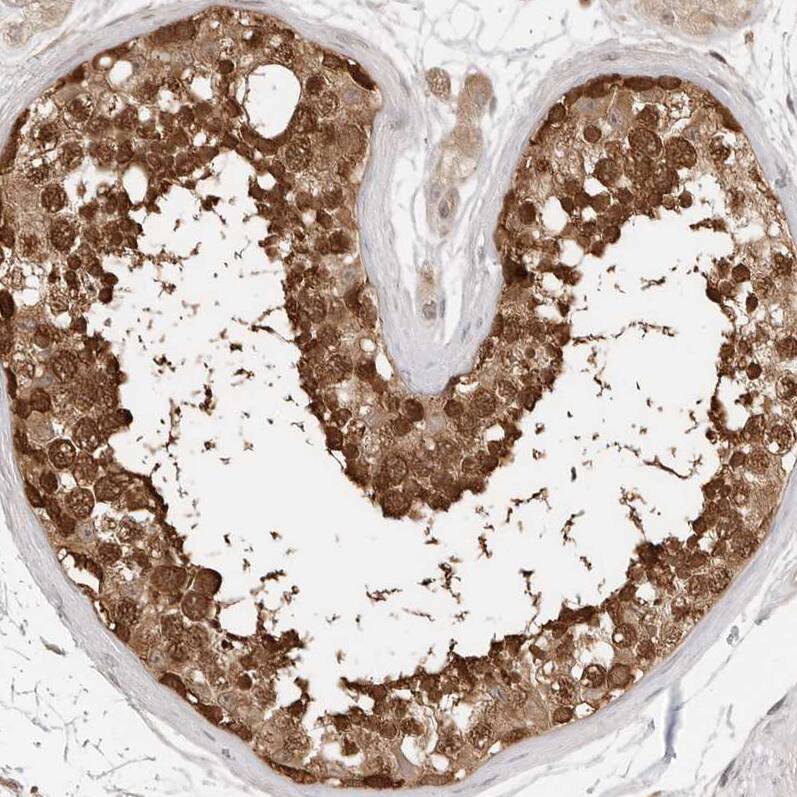 NUDC Antibody - BSA Free Immunohistochemistry-Paraffin: NUDC Antibody - BSA Free [NBP1-89517]