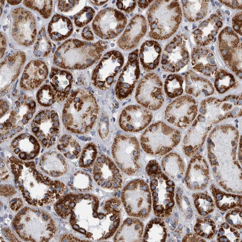 MDH2 Antibody - BSA Free Immunohistochemistry-Paraffin: MDH2 Antibody - BSA Free [NBP1-89518]