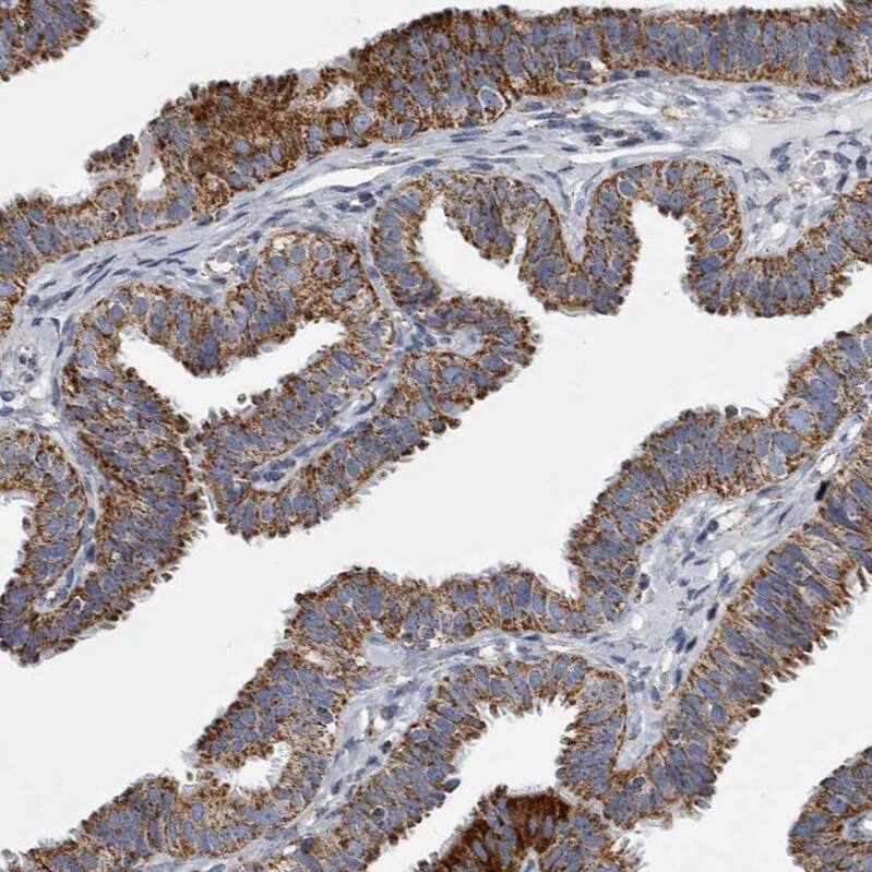 MDH2 Antibody - BSA Free Immunohistochemistry-Paraffin: MDH2 Antibody - BSA Free [NBP1-89518]