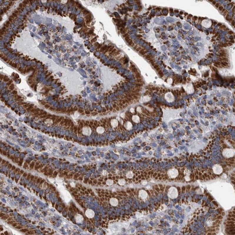 MDH2 Antibody - BSA Free Immunohistochemistry-Paraffin: MDH2 Antibody - BSA Free [NBP1-89518]
