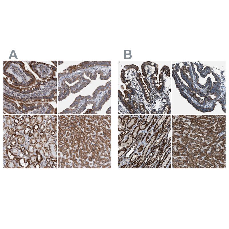 MDH2 Antibody - BSA Free Immunohistochemistry-Paraffin: MDH2 Antibody - BSA Free [NBP1-89518]
