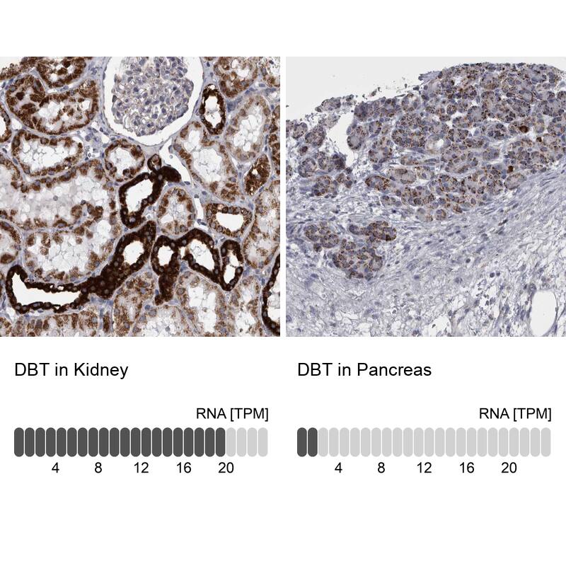 DBT Antibody - BSA Free Immunohistochemistry-Paraffin: DBT Antibody - BSA Free [NBP1-89522]