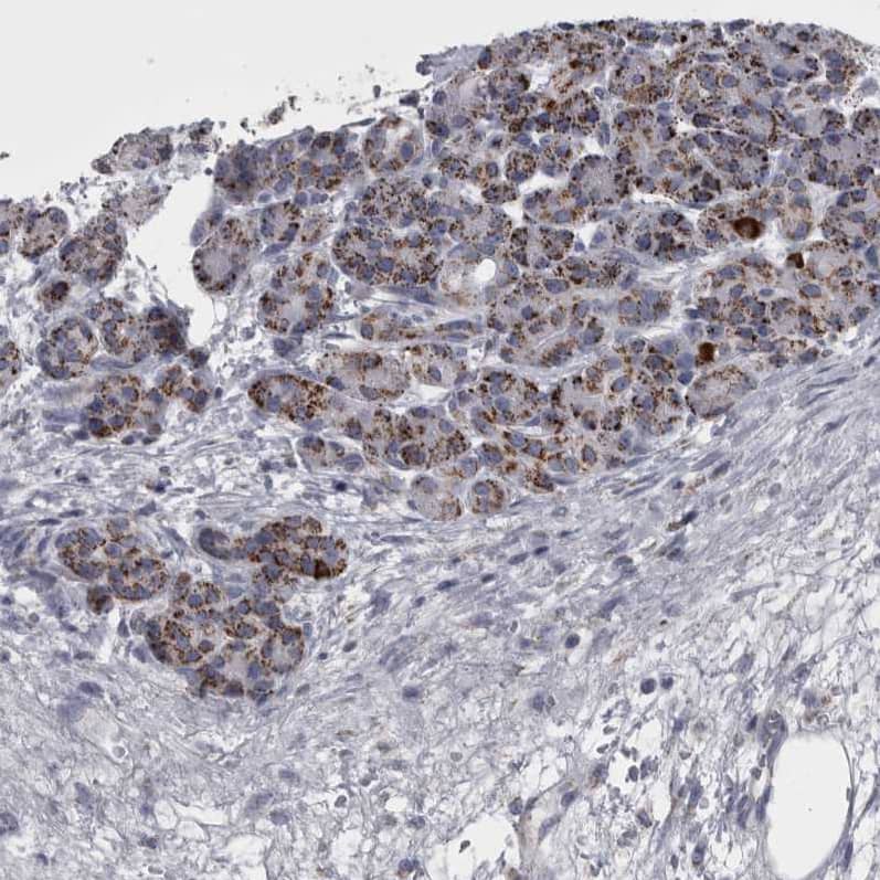 DBT Antibody - BSA Free Immunohistochemistry-Paraffin: DBT Antibody - BSA Free [NBP1-89522]