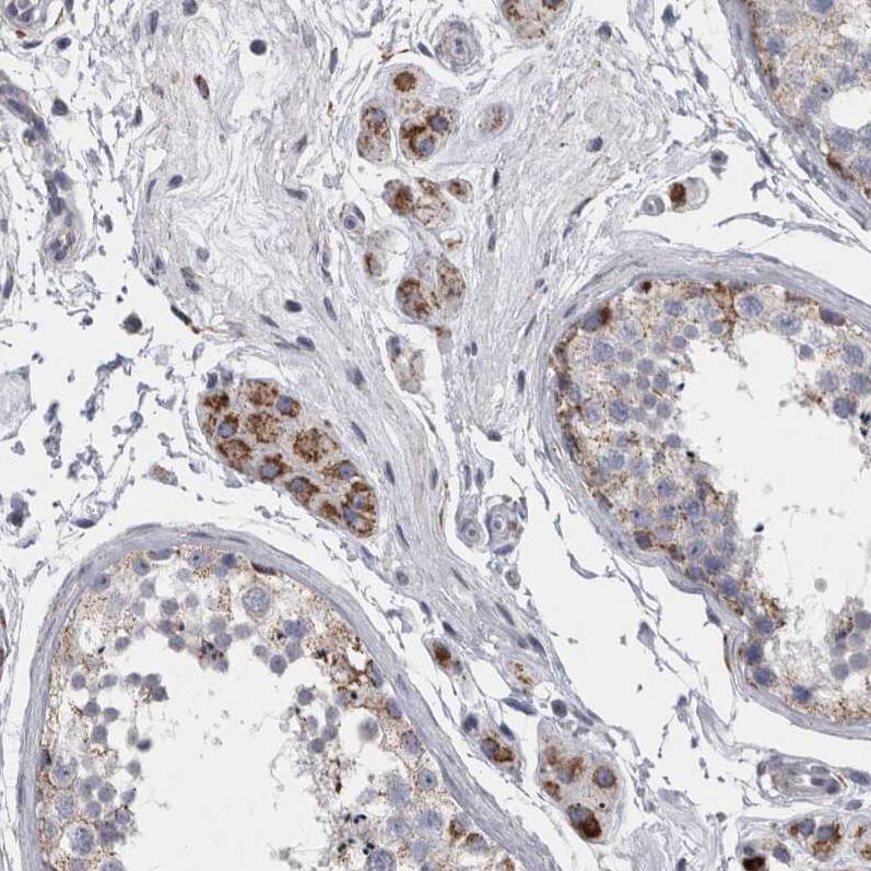 DBT Antibody - BSA Free Immunohistochemistry-Paraffin: DBT Antibody - BSA Free [NBP1-89522]