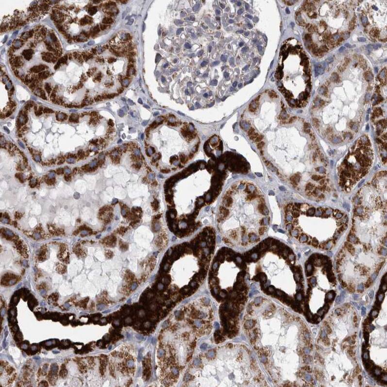 DBT Antibody - BSA Free Immunohistochemistry-Paraffin: DBT Antibody - BSA Free [NBP1-89522]