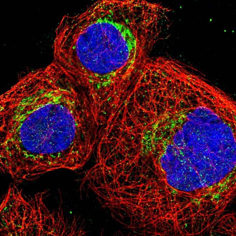 DBT Antibody - BSA Free Immunocytochemistry/ Immunofluorescence: DBT Antibody - BSA Free [NBP1-89522]