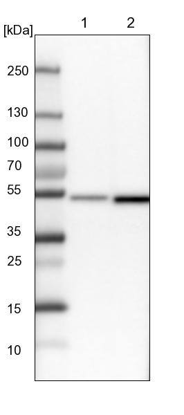 DBT Antibody - BSA Free Western Blot: DBT Antibody - BSA Free [NBP1-89522]