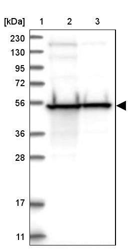 DBT Antibody - BSA Free Western Blot: DBT Antibody - BSA Free [NBP1-89522]