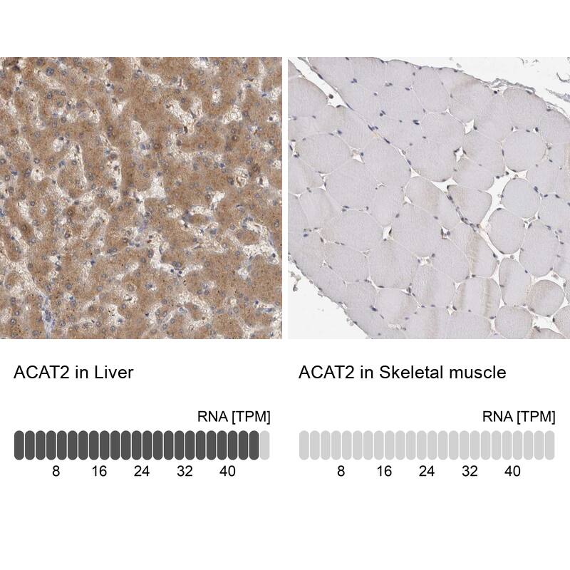 ACAT2 Antibody - BSA Free Immunohistochemistry-Paraffin: ACAT2 Antibody - BSA Free [NBP1-89526]
