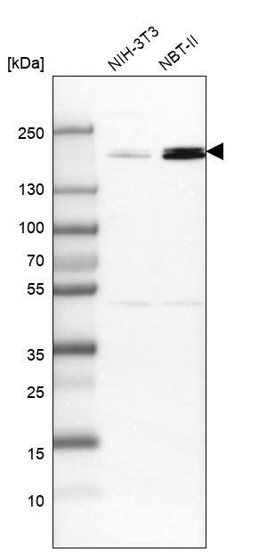 TOP2B Antibody - BSA Free Western Blot: TOP2B Antibody - BSA Free [NBP1-89527]