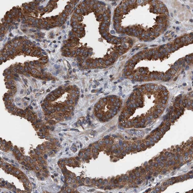 BAIAP2L1 Antibody - BSA Free Immunohistochemistry-Paraffin: BAIAP2L1 Antibody - BSA Free [NBP1-89528]