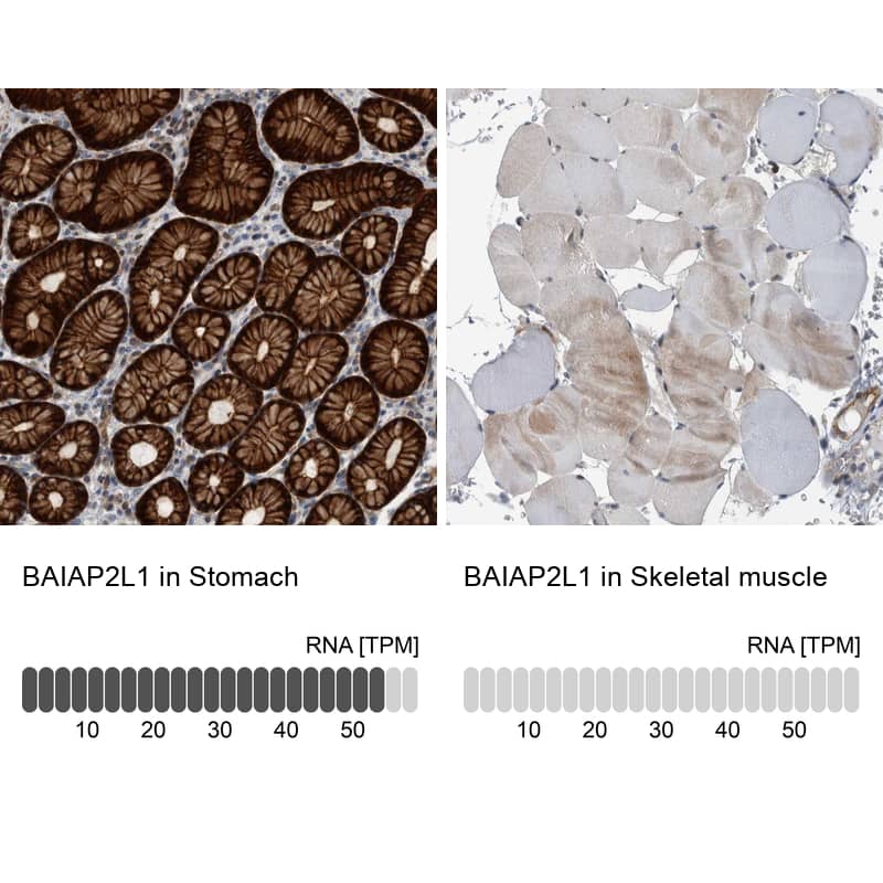 BAIAP2L1 Antibody - BSA Free Immunohistochemistry-Paraffin: BAIAP2L1 Antibody - BSA Free [NBP1-89528]