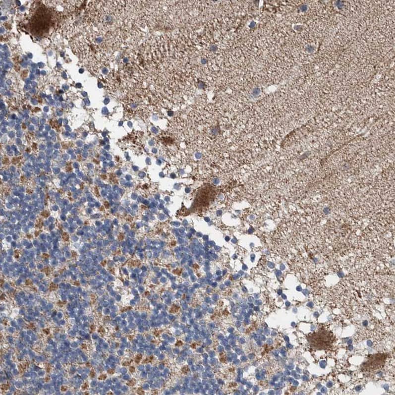 BAIAP2L1 Antibody - BSA Free Immunohistochemistry-Paraffin: BAIAP2L1 Antibody - BSA Free [NBP1-89528]