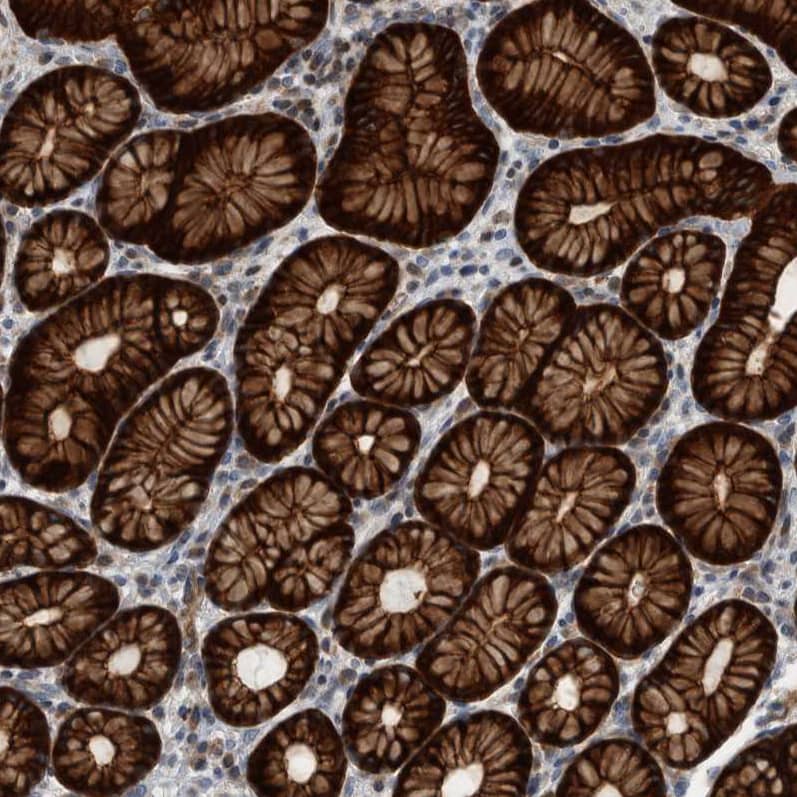 BAIAP2L1 Antibody - BSA Free Immunohistochemistry-Paraffin: BAIAP2L1 Antibody - BSA Free [NBP1-89528]