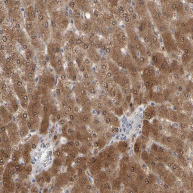 EPHX2 Antibody - BSA Free Immunohistochemistry-Paraffin: EPHX2 Antibody - BSA Free [NBP1-89531]