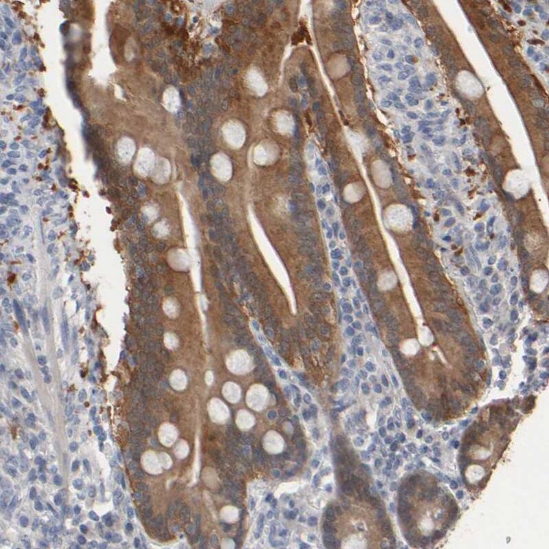 EPHX2 Antibody - BSA Free Immunohistochemistry-Paraffin: EPHX2 Antibody - BSA Free [NBP1-89531]