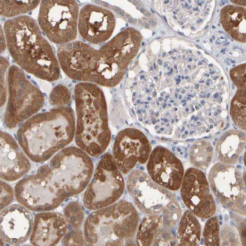EPHX2 Antibody - BSA Free Immunohistochemistry-Paraffin: EPHX2 Antibody - BSA Free [NBP1-89531]