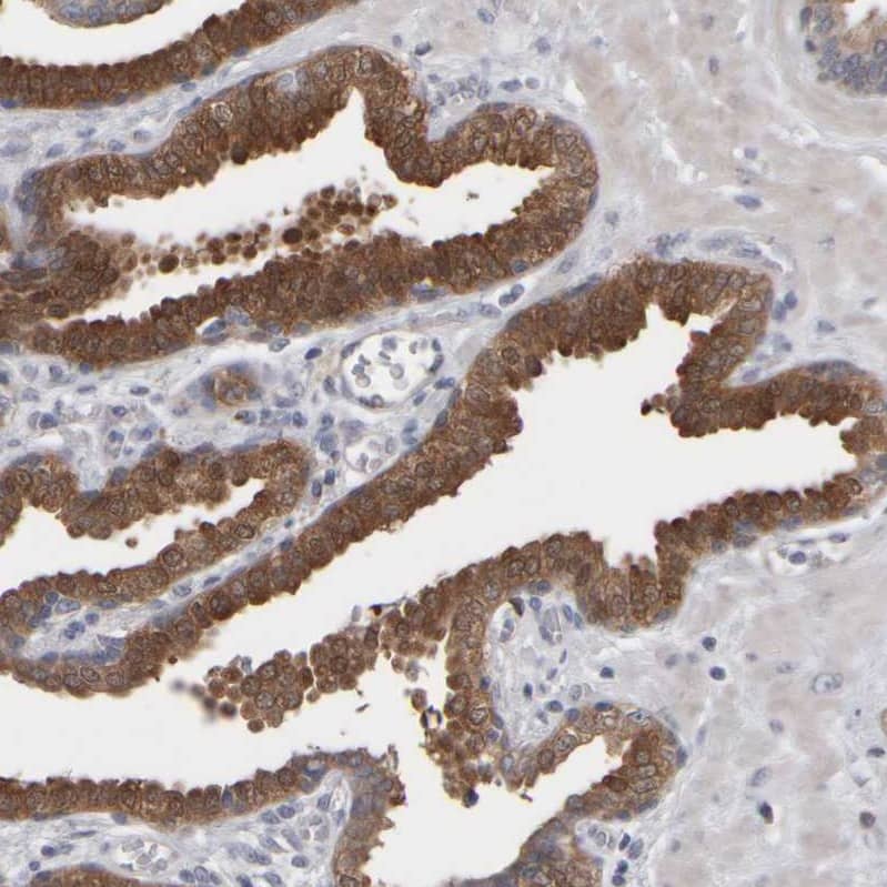 EPHX2 Antibody - BSA Free Immunohistochemistry-Paraffin: EPHX2 Antibody - BSA Free [NBP1-89531]