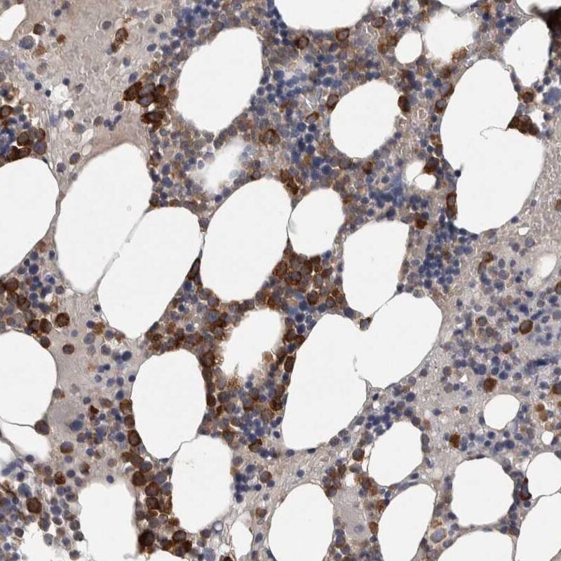 SRP68 Antibody - BSA Free Immunohistochemistry-Paraffin: SRP68 Antibody [NBP1-89532]