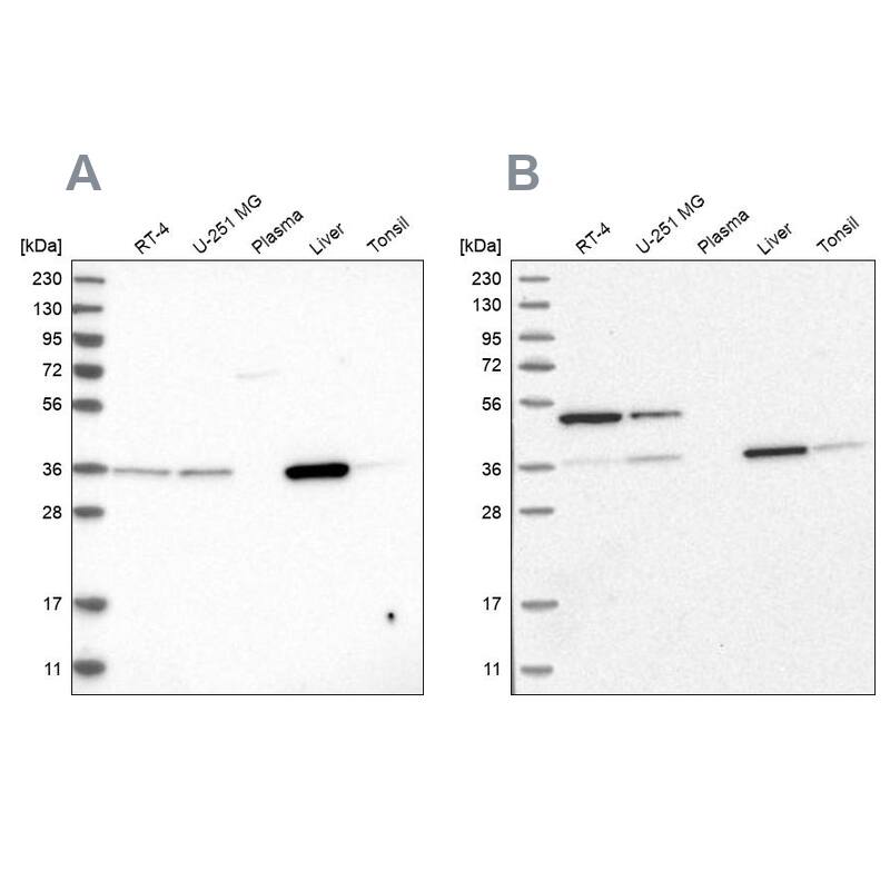 CRYZ Antibody - BSA Free Western Blot: CRYZ Antibody - BSA Free [NBP1-89533]
