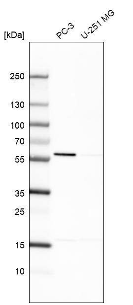 EPHX2 Antibody - BSA Free Western Blot: EPHX2 Antibody - BSA Free [NBP1-89534]