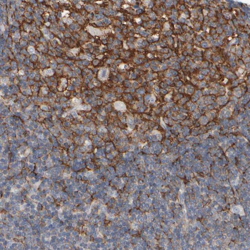 EPHX2 Antibody - BSA Free Immunohistochemistry-Paraffin: EPHX2 Antibody - BSA Free [NBP1-89534]