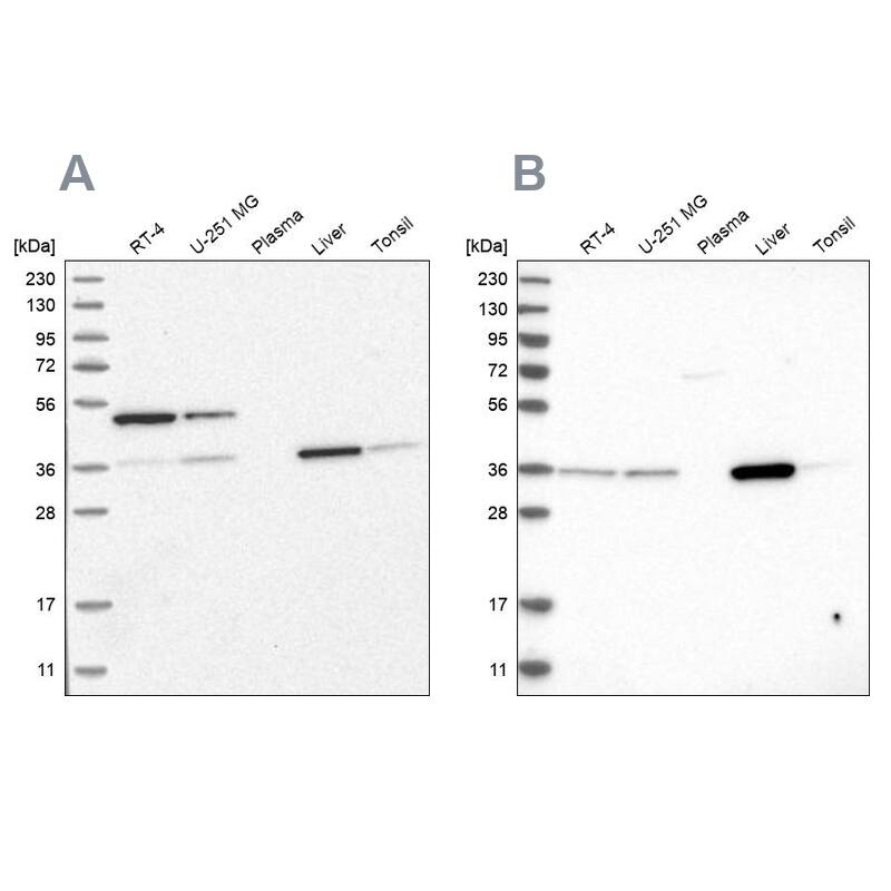 CRYZ Antibody - BSA Free Western Blot: CRYZ Antibody - BSA Free [NBP1-89536]