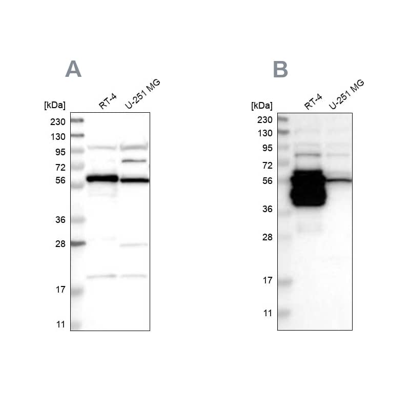 BAIAP2L1 Antibody - BSA Free Western Blot: BAIAP2L1 Antibody - BSA Free [NBP1-89537]